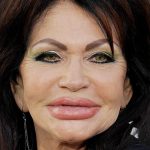 plastic surgery fail